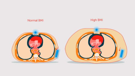 Fat Tissue DFT Thumbnail