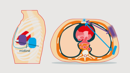 Generator Positioning DFT Thumbnail